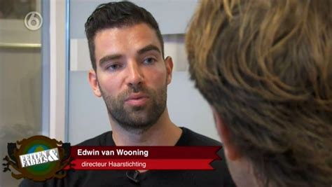 Haartransplantatie In De Media: Feiten En Fabels